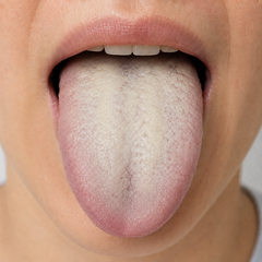 Deep and stubborn tongue clue