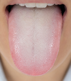 Cold and stiff tongue clue