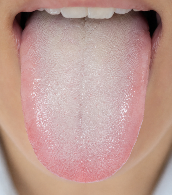 Pale puffy moist tongue with white slippery coating
