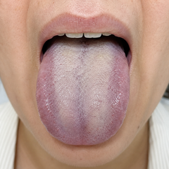 Nerve-like signs tongue clue