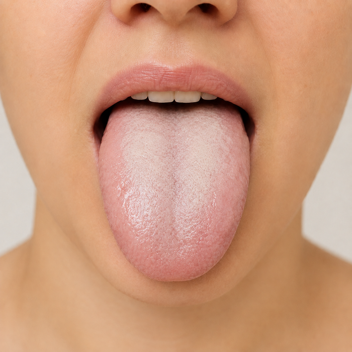 Tongue clue for Kidney Yang deficiency